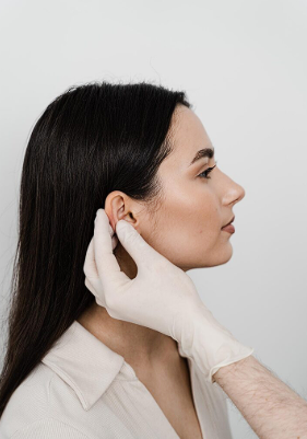 Otoplastia