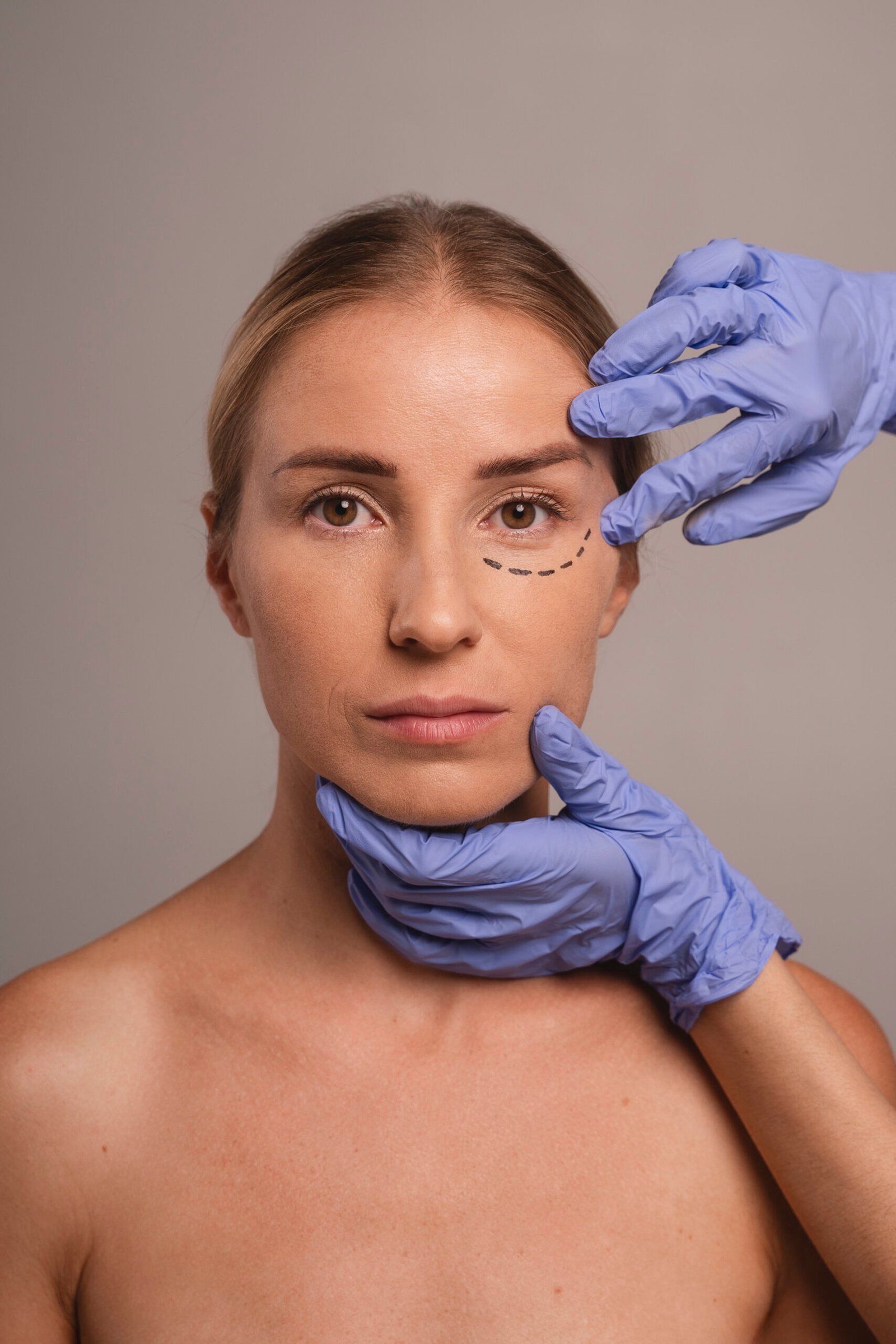 Blefaroplastia